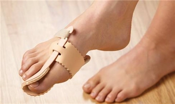 Ayak Başparmak Çıkıntısı