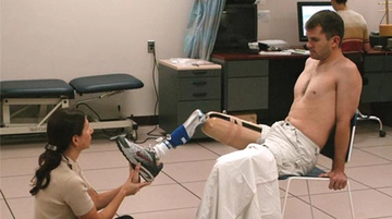 Protez Ayak Özellikleri